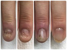 エマネイル(emma nail)