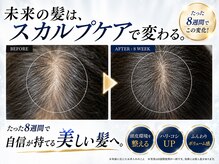 BLD/クリニカルスカルプケアB&A4