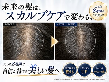 BLD/クリニカルスカルプケアB&A4