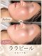 フルールドリス(FLEUR DE LIS)の写真/【シミ/しわ/くすみ】韓国ララピールで透明感アップ！すでに出来てしまったシミしわにも◎