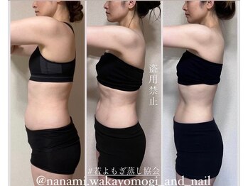 ルアナ(Runa)の写真/産後ケアで自分らしく。サイズダウンを目指すダイエットでリラックスタイムを♪