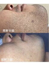カルナ(Caruna)/男性ご新規様、受付一時停止中