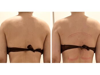 ルミノ 心斎橋(Rumino)/肩こりケア