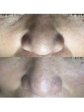 シャイニー(SHINY)/60代女性