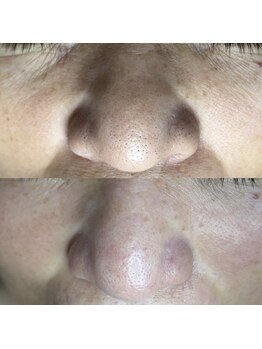 シャイニー(SHINY)/60代女性