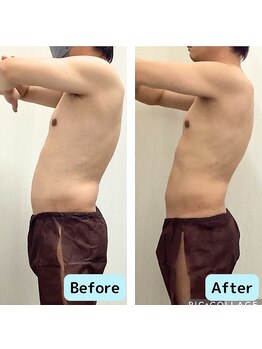 リオンズ 千葉アリオ柏店/2ケ月で7.4kg減量【痩身】