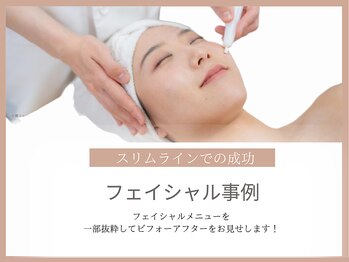 スリムライン 青森店(The Slim Line)/フェイシャルbefore→afterを