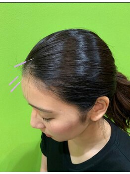 西宮わだち整骨院の写真/自律神経の乱れの不調、辛い首肩こりや眼精疲労、頭痛・不眠でお悩みの方も当院独自の施術で改善します！
