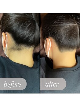 エピナス 町田店(epinus)/結婚式や成人式前にも!即ツル!