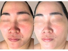 ウォナ(WONA)/【お客様症例】