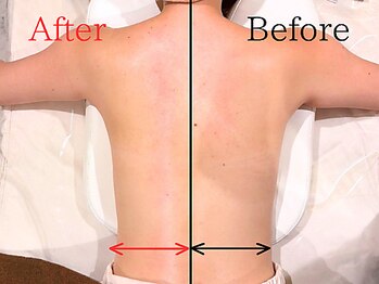 ナリッシュ バスト 六本木(Nouriche Bust)/根本改善☆バストアップ