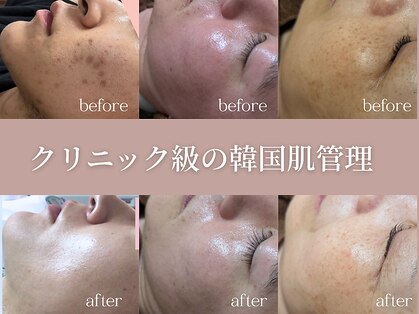 グランクウォーレ(Gran Cuore)の写真