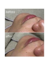 脱毛サロンnamir札幌店【ブラジリアンワックス/美容脱毛/眉毛】～メンズ/レディース～/lady【お顔ワックス】