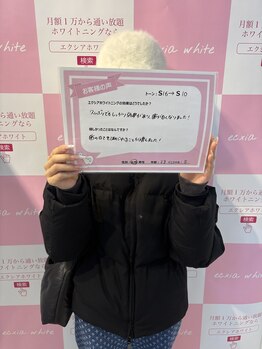 エクシアホワイトニング 前橋店/お客様の声