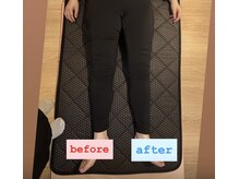 ヨサパーク ペチュニア 世田谷店(YOSA PARK Petunia)/マッサージだけでの変化