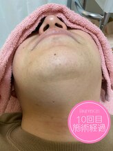 ローランサン(laurencin)/【After2】