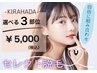 セレクト脱毛【自由に選べる3部位】※顔VIO以外、レディース