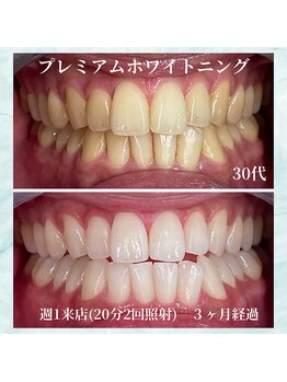 ホワイトニングビューティー 名古屋栄店(WHITENING BEAUTY)/セルフホワイトニング