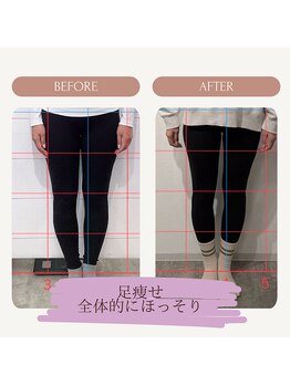 アンダーセブン(Under Seven)/お客様の変化★美脚