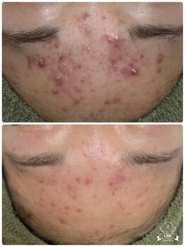 オーブ(Aube)/【20代　お客様before after】