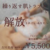 アネラ(Anela)