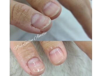 デコボコ/凸凹爪も修繕改善！！