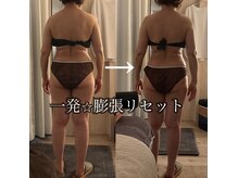 プラスイチド/ストレスで筋肉はかたくなる