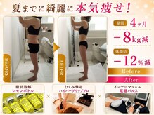 クリニカルエステ イーズ 三宮店