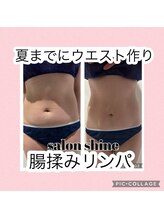 サロンシャイン(Salon Shine)/オールハンド腸揉みリンパ３０代