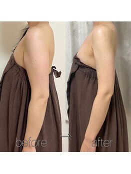 ビュール 銀座(BeauL)/二の腕ほっそり