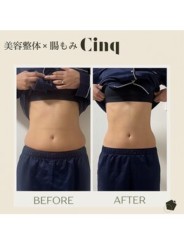 サンク(Cinq)/腸もみでぽっこりお腹スッキリ