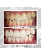 スイレン 西新宿(SUIREN)/月8800ホワイトニング通い放題