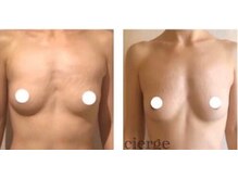 エスビューティー 三軒茶屋(S beauty)/バストケア・池尻大橋・痩身