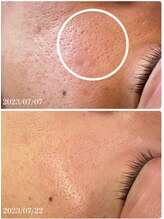 スリリアン 銀座/★お客さまビフォーアフター★