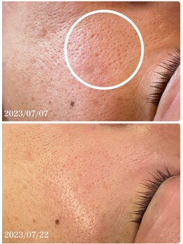 スリリアン 銀座/★お客さまビフォーアフター★