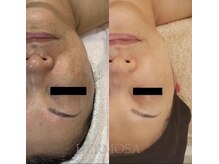 ビーカーブス 三鷹(B.curves)/before・after