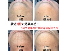 アルビーダ(RBDA)の雰囲気（効果に特化したメンズ脱毛をご提供！！）