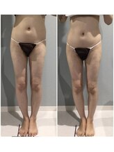 アイ アンド ネイル(Eye＆Nail Day)/痩身コース☆