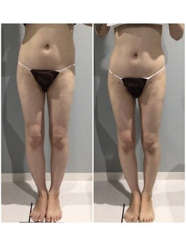 アイ アンド ネイル(Eye＆Nail Day)/痩身コース☆