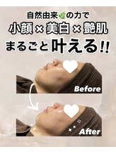 ビレボ マエバシ(BEREVO maebashi)/Before After