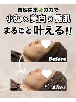 ビレボ マエバシ(BEREVO maebashi)/Before After