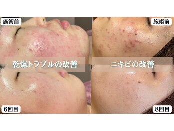 エヌエースキン たまプラーザ店(NAskin)