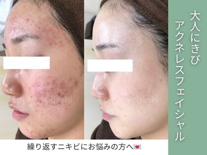 エピア 豊橋店(Epia)の写真