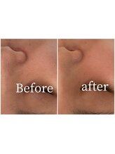 モイ(moi.)/◆セラピール◆