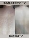 ウィズサロン 天神大名店(withサロン)の写真/【結果重視】ハーブピーリングで本気の肌質改善★二の腕のニキビケア◎ハーブピーリングご新規様クーポン有
