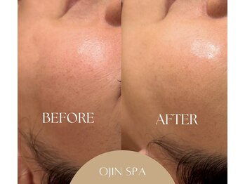 オージン スパ(OJIN SPA)の写真/【次世代ピーリング★ララピール】剥がさず満たす新発想ケア。内側から輝くような理想の水光肌へ導きます◇