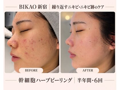 ビカオ(BIKAO)の写真