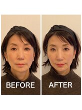 アマルジーナ(AmalZwina)/【パーソナルカラー診断】