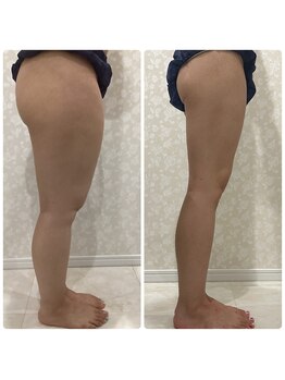 ディオーネ(Dione)/足ほっそり♪美脚への道★