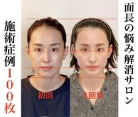 小顔22 ボルティ 赤坂支店(Bolty)